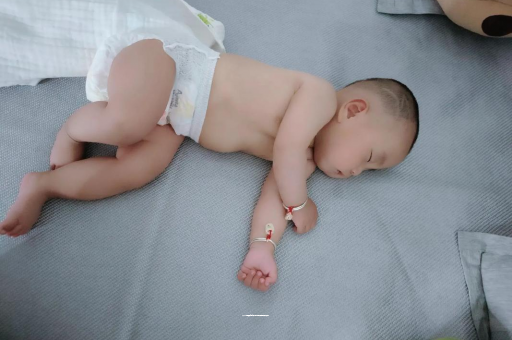 常州六个月宝宝眼睛散光